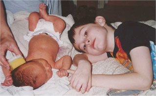 Matthew Pre-Op Jan 2001, with newborn sister Emma